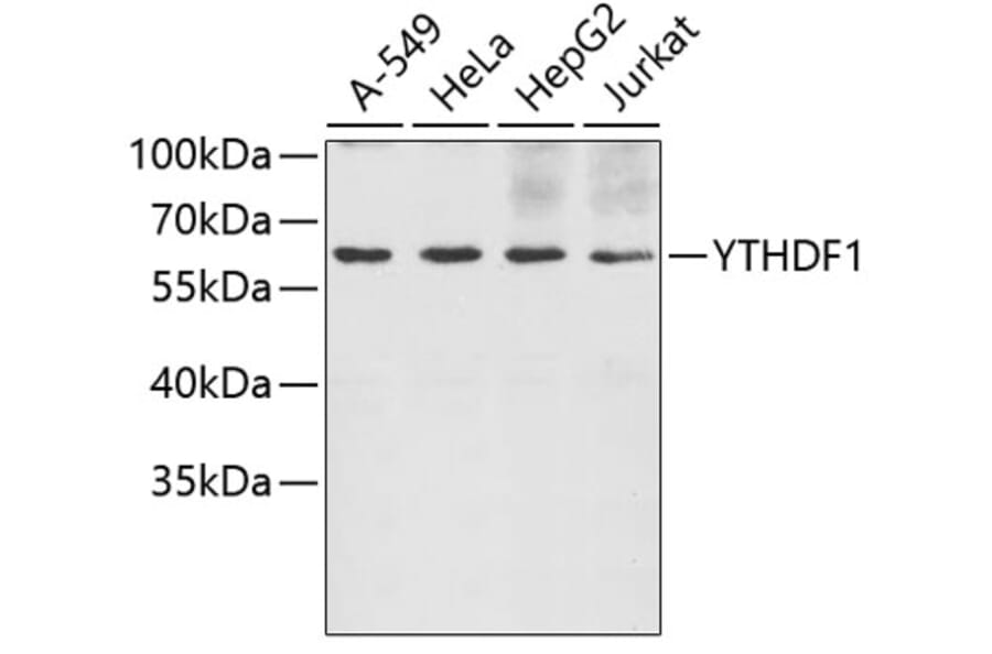 Western Blot - Anti-YTHDF1 Antibody (A5985) - Antibodies.com