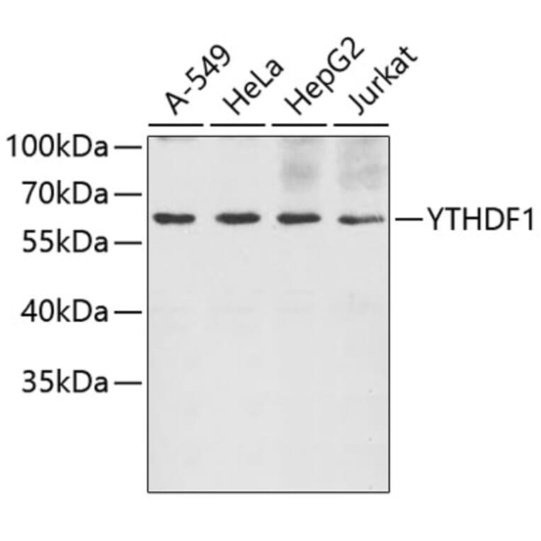 Western Blot - Anti-YTHDF1 Antibody (A5985) - Antibodies.com