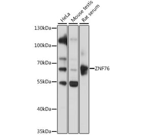 Western Blot - Anti-ZNF76 Antibody (A90744) - Antibodies.com