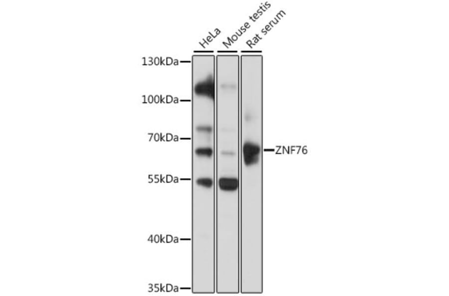 Western Blot - Anti-ZNF76 Antibody (A90744) - Antibodies.com