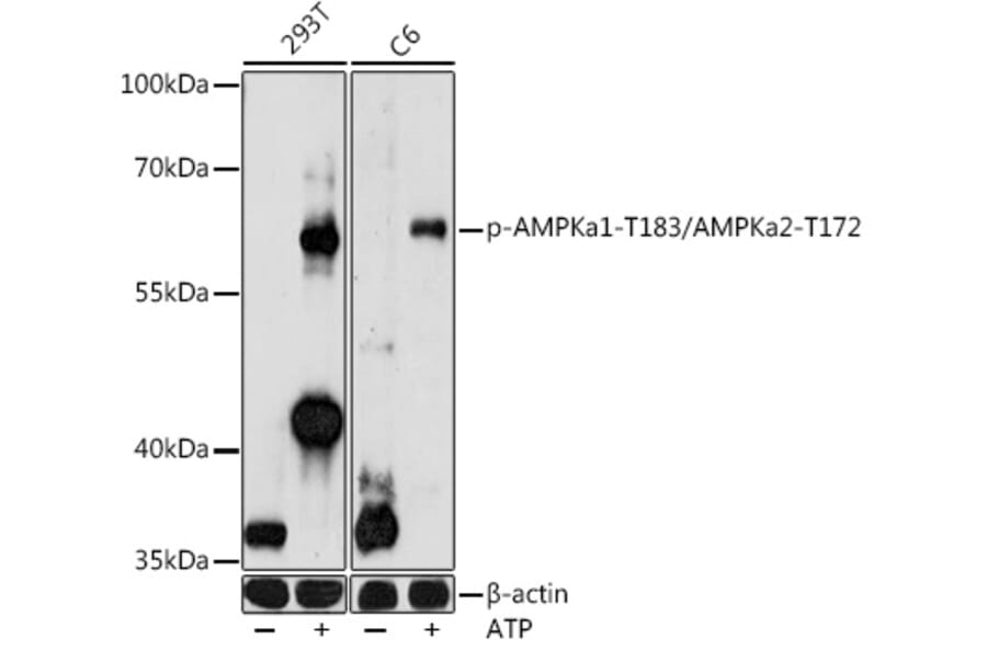 Western Blot - Anti-AMPK alpha 1 (phospho Thr183) + AMPK alpha 2 (phospho Thr172) Antibody (A90745) - Antibodies.com