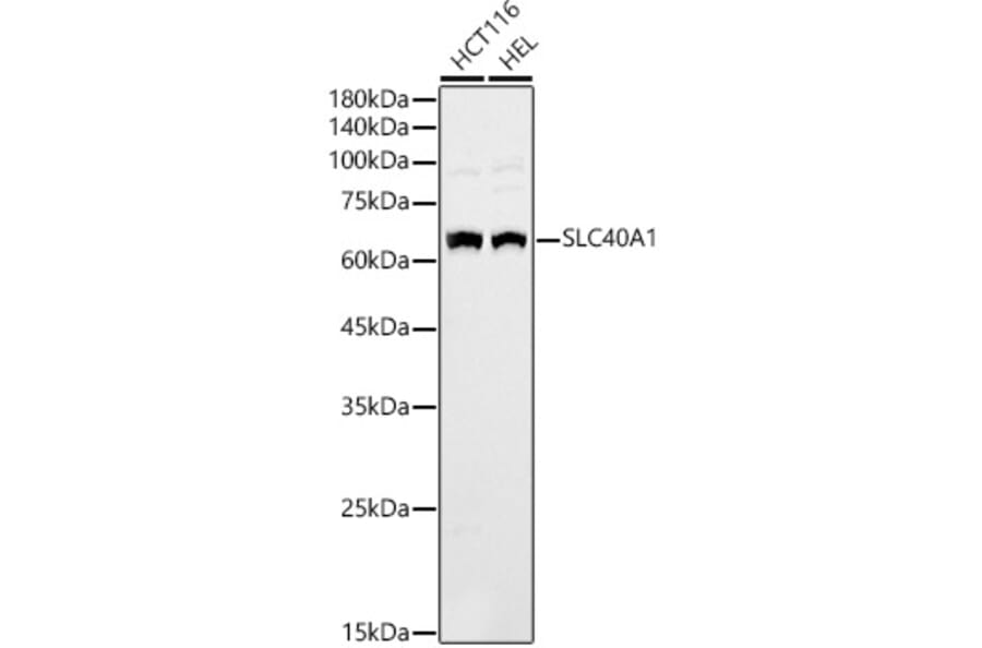 Western Blot - Anti-SLC40A1 Antibody (A90746) - Antibodies.com