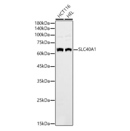 Western Blot - Anti-SLC40A1 Antibody (A90746) - Antibodies.com