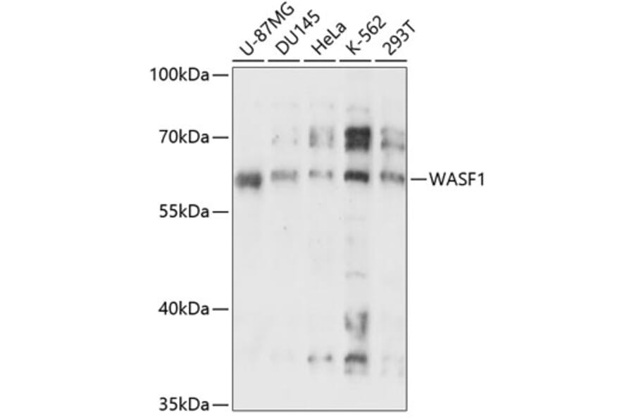 Western Blot - Anti-WAVE 1 Antibody (A90747) - Antibodies.com