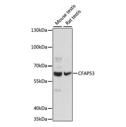 Western Blot - Anti-CCDC11 Antibody (A90748) - Antibodies.com