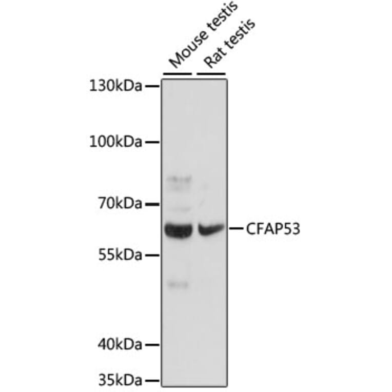Western Blot - Anti-CCDC11 Antibody (A90748) - Antibodies.com