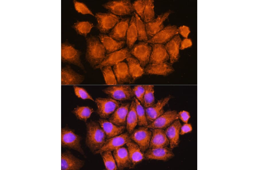 Immunofluorescence - Anti-CCDC11 Antibody (A90748) - Antibodies.com