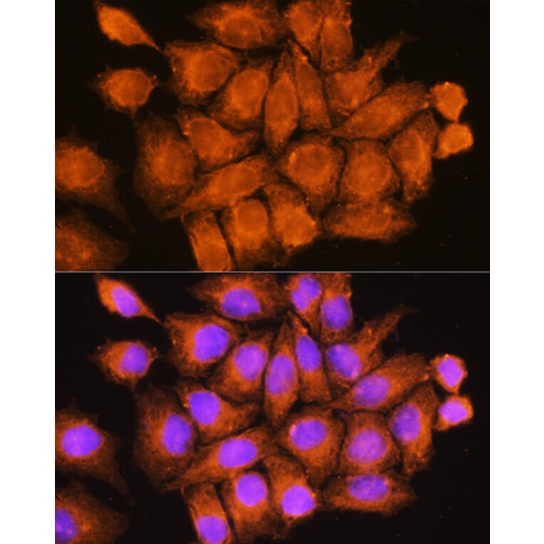 Immunofluorescence - Anti-CCDC11 Antibody (A90748) - Antibodies.com