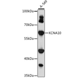 Western Blot - Anti-KCNA10 Antibody (A90749) - Antibodies.com