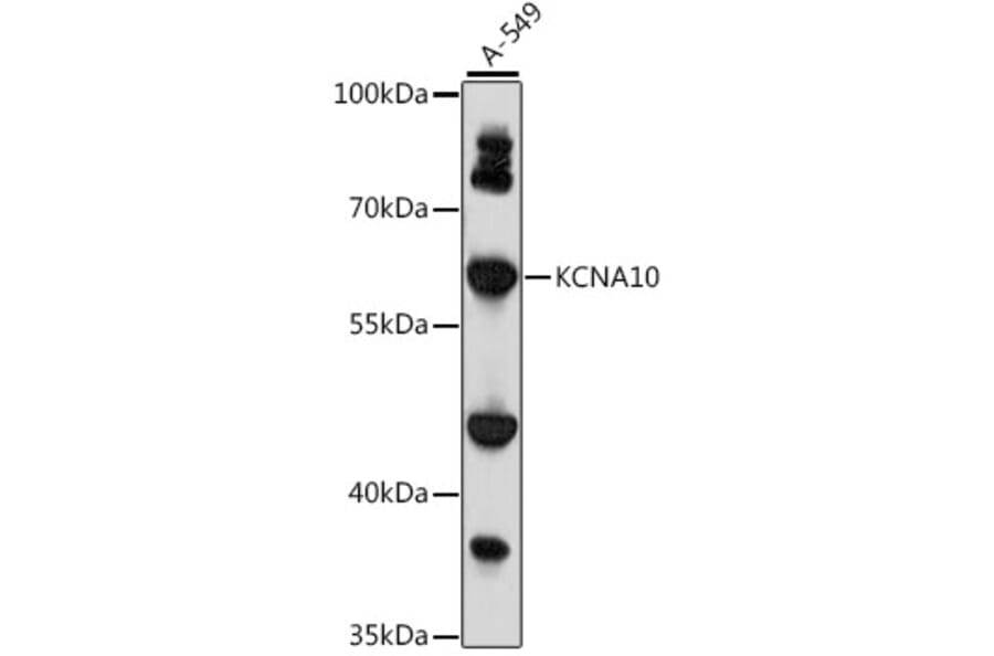 Western Blot - Anti-KCNA10 Antibody (A90749) - Antibodies.com