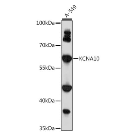 Western Blot - Anti-KCNA10 Antibody (A90749) - Antibodies.com