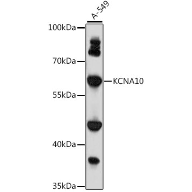 Western Blot - Anti-KCNA10 Antibody (A90749) - Antibodies.com