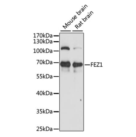 Western Blot - Anti-FEZ1 Antibody (A90750) - Antibodies.com