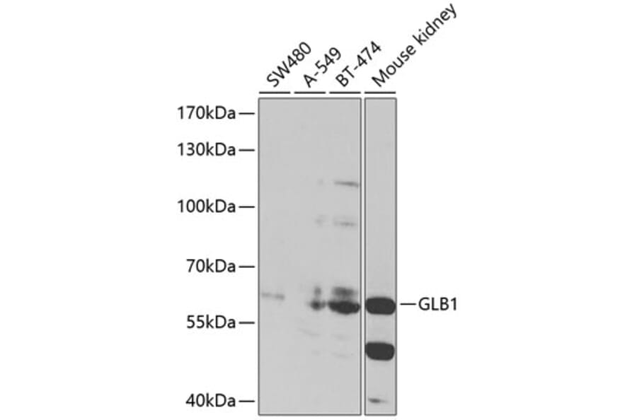 Western Blot - Anti-GLB1/Beta-galactosidase Antibody (A90751) - Antibodies.com