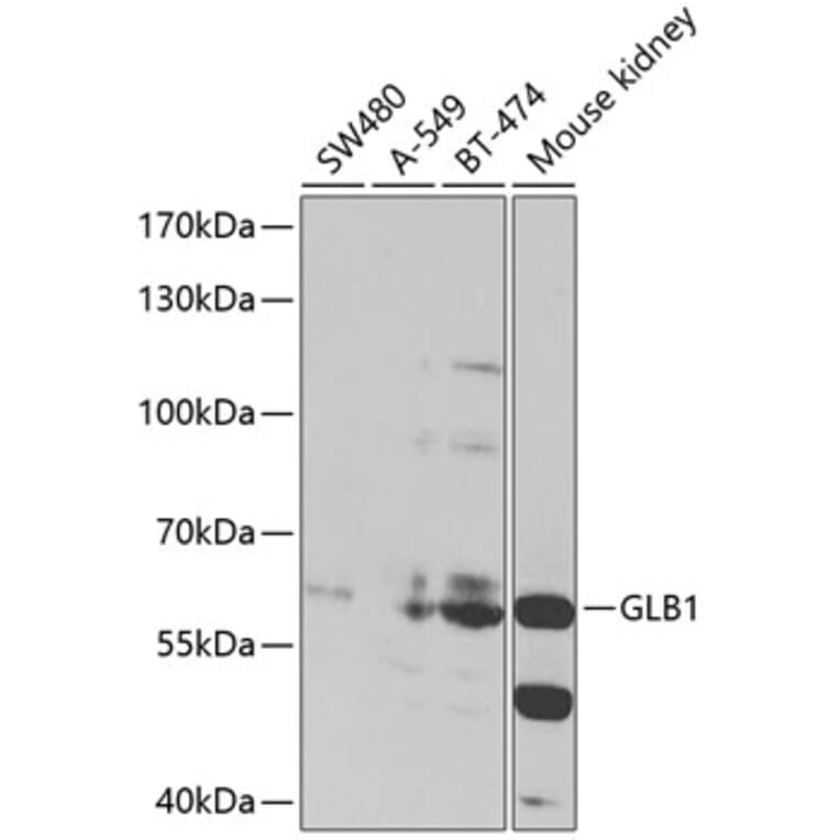 Western Blot - Anti-GLB1/Beta-galactosidase Antibody (A90751) - Antibodies.com