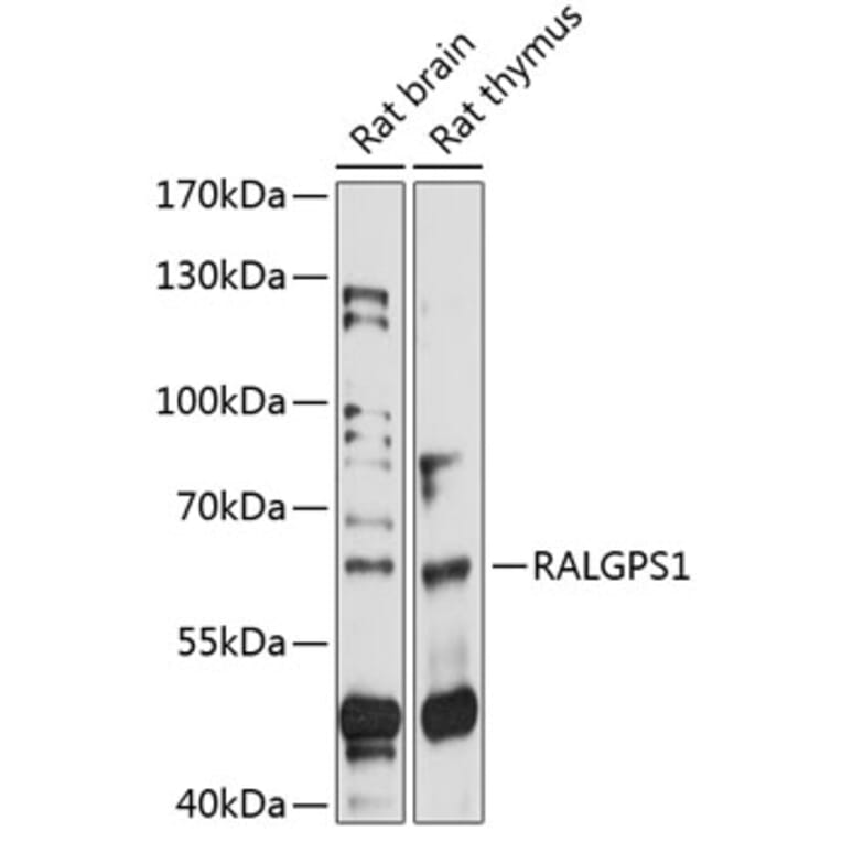 Western Blot - Anti-RALGPS1 Antibody (A90753) - Antibodies.com