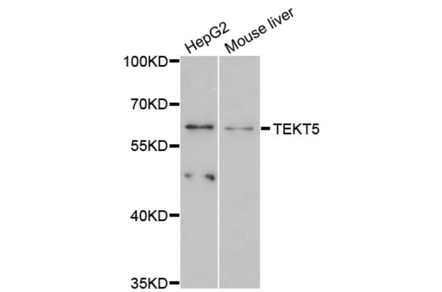 Western Blot - Anti-TEKT5 Antibody (A12378) - Antibodies.com