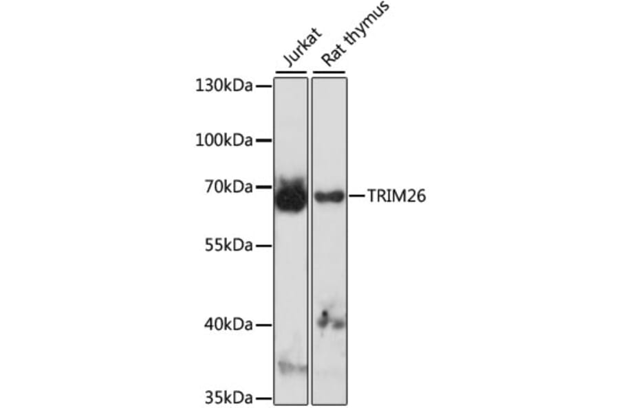 Western Blot - Anti-TRIM26 Antibody (A90755) - Antibodies.com