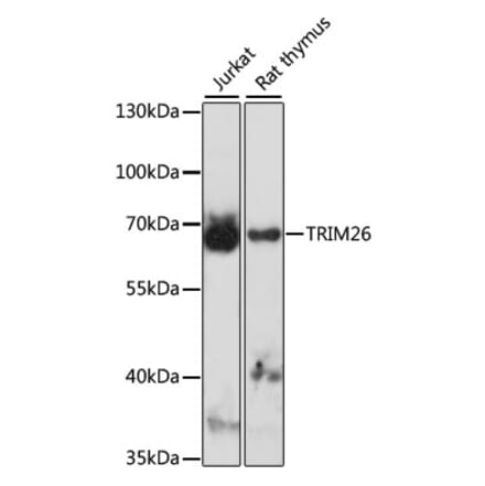 Western Blot - Anti-TRIM26 Antibody (A90755) - Antibodies.com