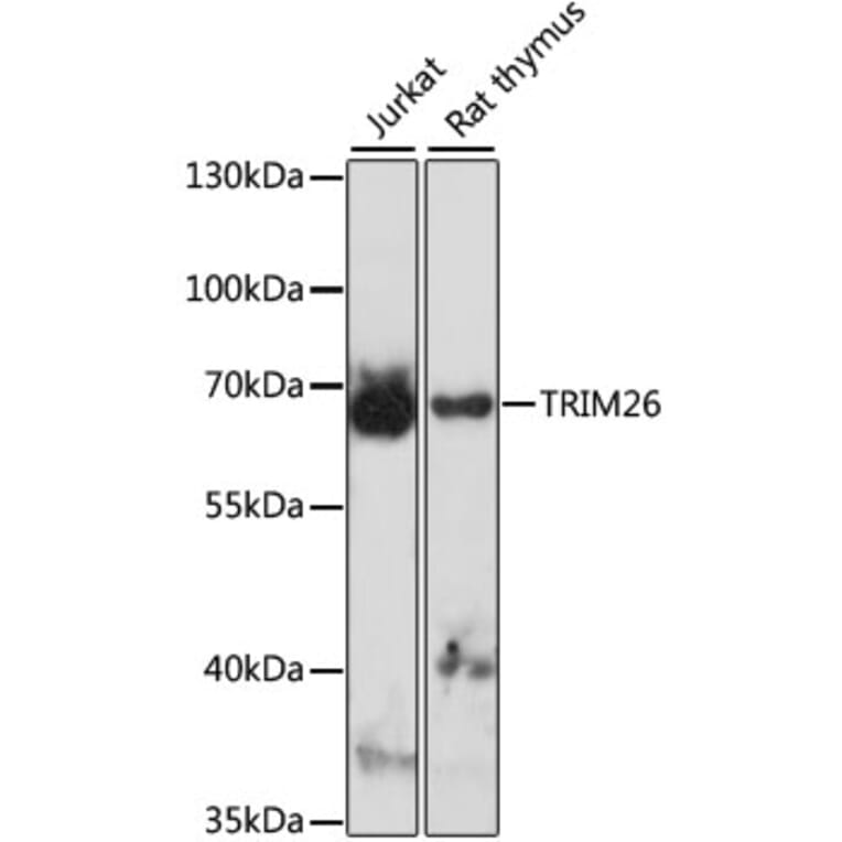 Western Blot - Anti-TRIM26 Antibody (A90755) - Antibodies.com