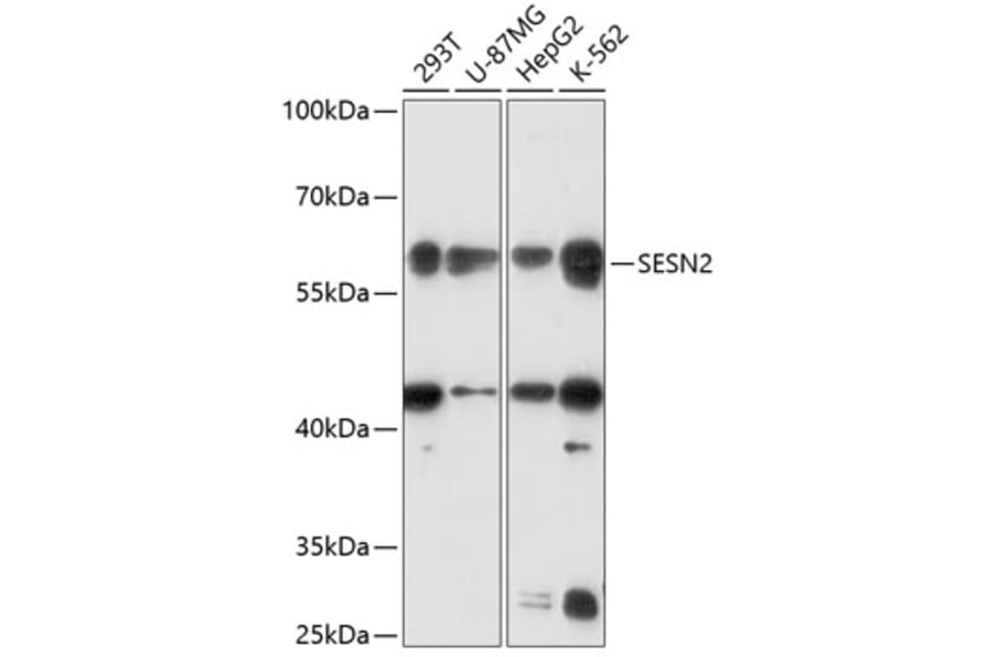Western Blot - Anti-SESN2/Sestrin-2 Antibody (A90756) - Antibodies.com