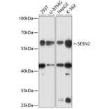 Western Blot - Anti-SESN2/Sestrin-2 Antibody (A90756) - Antibodies.com