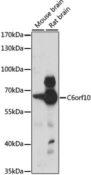 Western blot analysis of extracts of various cell lines, using Anti-C6orf10 Antibody (A15390) at 1:1,000 dilution.
Secondary antibody: Goat Anti-Rabbit IgG (H+L) (HRP) (AS014) at 1:10,000 dilution.
Lysates / proteins: 25µg per lane.
Blocking buffer: 3% non-fat dry milk in TBST.
Detection: ECL Basic Kit (RM00020).
Exposure time: 30s.