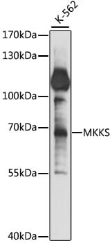 Western blot analysis of extracts of K-562 cells, using Anti-MKKS Antibody (A15336) at 1:1,000 dilution.
Secondary antibody: Goat Anti-Rabbit IgG (H+L) (HRP) (AS014) at 1:10,000 dilution.
Lysates / proteins: 25µg per lane.
Blocking buffer: 3% non-fat dry milk in TBST.
Detection: ECL Basic Kit (RM00020).
Exposure time: 20s.