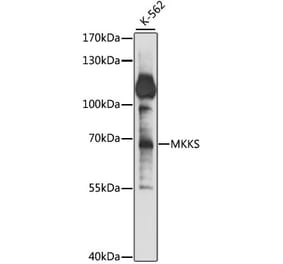 Western Blot - Anti-MKKS Antibody (A90758) - Antibodies.com