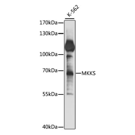 Western Blot - Anti-MKKS Antibody (A90758) - Antibodies.com