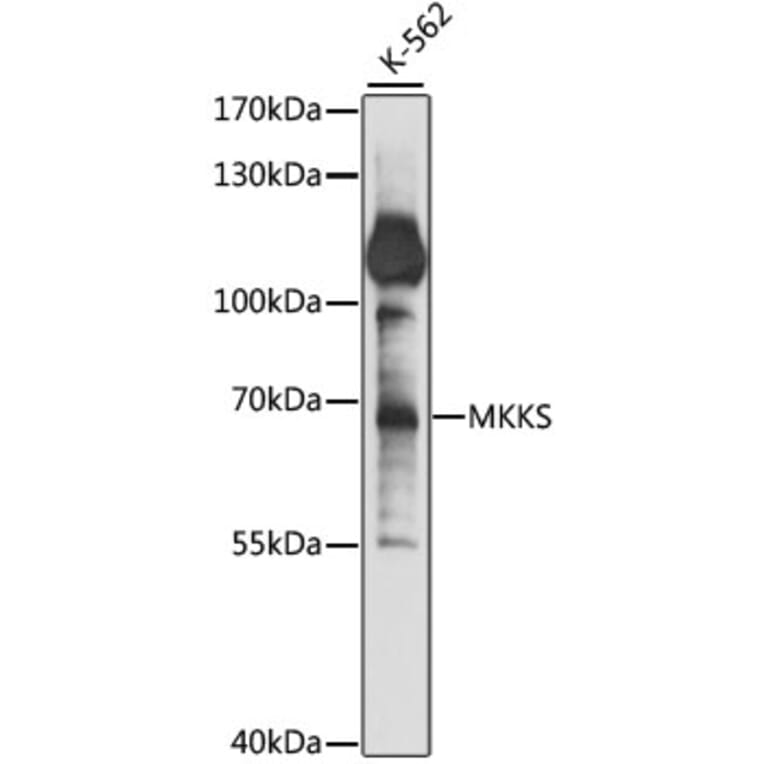 Western Blot - Anti-MKKS Antibody (A90758) - Antibodies.com