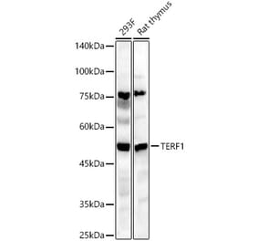 Western Blot - Anti-TRF1 Antibody (A90759) - Antibodies.com