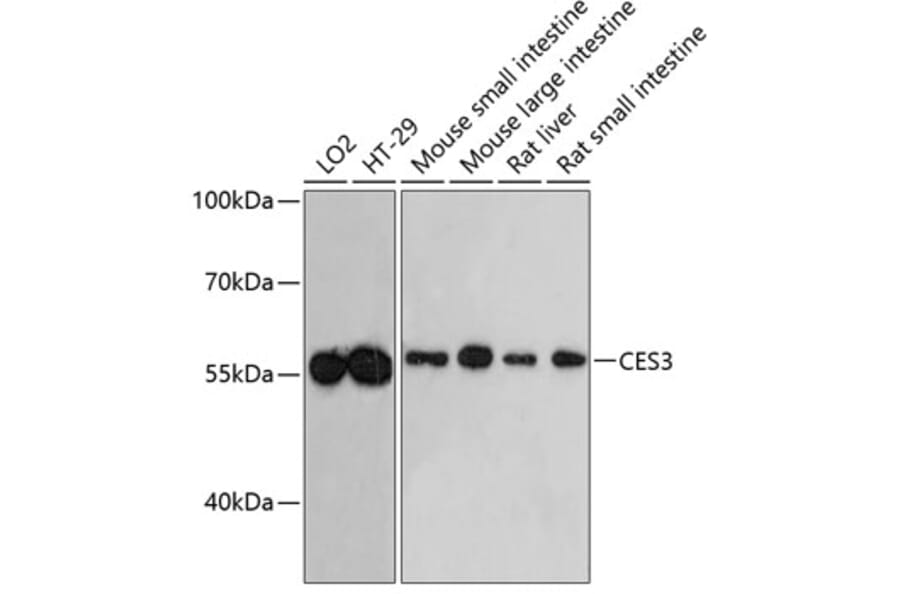 Western Blot - Anti-CES3/TGH Antibody (A90760) - Antibodies.com
