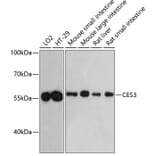 Western Blot - Anti-CES3/TGH Antibody (A90760) - Antibodies.com