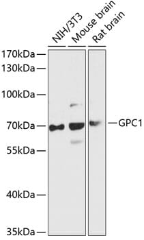 Anti-Glypican 1 / GPC1 Antibody (A90761) | Antibodies.com