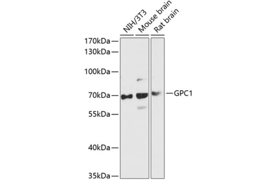 Western Blot - Anti-Glypican 1/GPC1 Antibody (A90761) - Antibodies.com