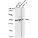 Western Blot - Anti-Glypican 1/GPC1 Antibody (A90761) - Antibodies.com