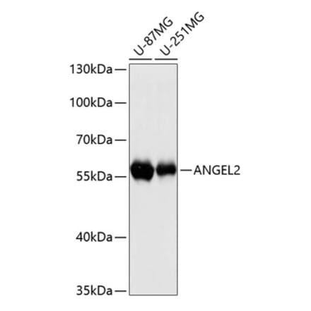 Western Blot - Anti-ANGEL2 Antibody (A90762) - Antibodies.com