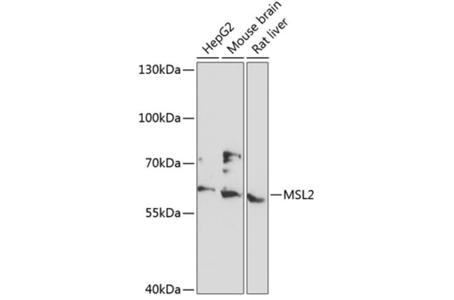 Western Blot - Anti-MSL2 Antibody (A90763) - Antibodies.com