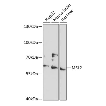 Western Blot - Anti-MSL2 Antibody (A90763) - Antibodies.com