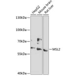 Western Blot - Anti-MSL2 Antibody (A90763) - Antibodies.com