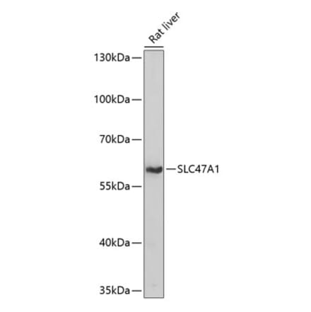 Western Blot - Anti-MATE-1 Antibody (A90765) - Antibodies.com