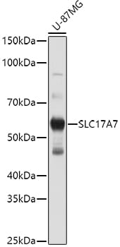 Western blot analysis of extracts of SH-SY5Y cells, using Anti-SLC17A7 Antibody (A12879) at 1:3000 dilution.
Secondary antibody: Goat Anti-Rabbit IgG (H+L) (HRP) (AS014) at 1:10,000 dilution.
Lysates / proteins: 25µg per lane.
Blocking buffer: 3% non-fat dry milk in TBST.
Detection: ECL Basic Kit (RM00020).
Exposure time: 30s.