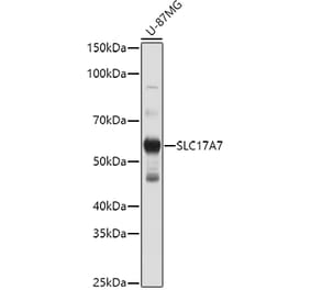 Western Blot - Anti-VGluT1 Antibody (A90766) - Antibodies.com