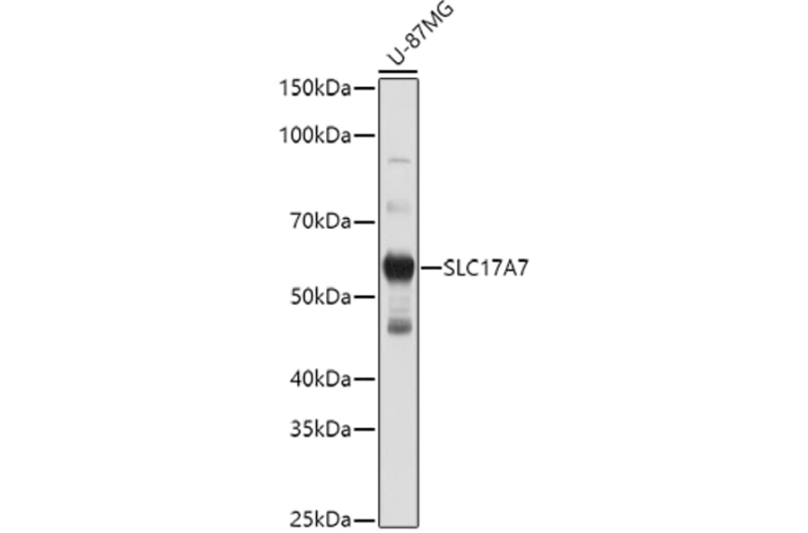 Western Blot - Anti-VGluT1 Antibody (A90766) - Antibodies.com
