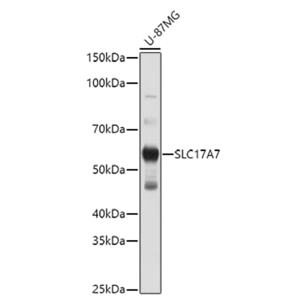 Western Blot - Anti-VGluT1 Antibody (A90766) - Antibodies.com