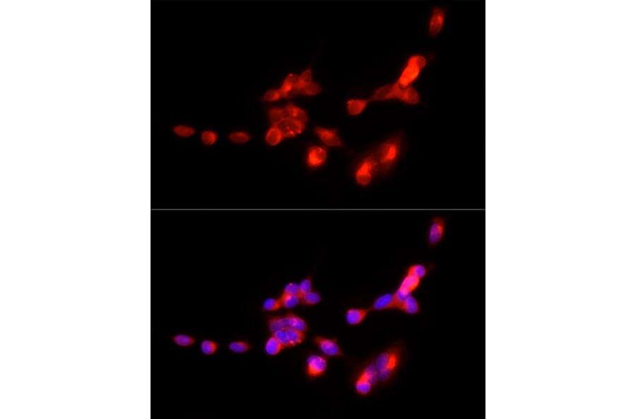 Immunofluorescence - Anti-VGluT1 Antibody (A90766) - Antibodies.com