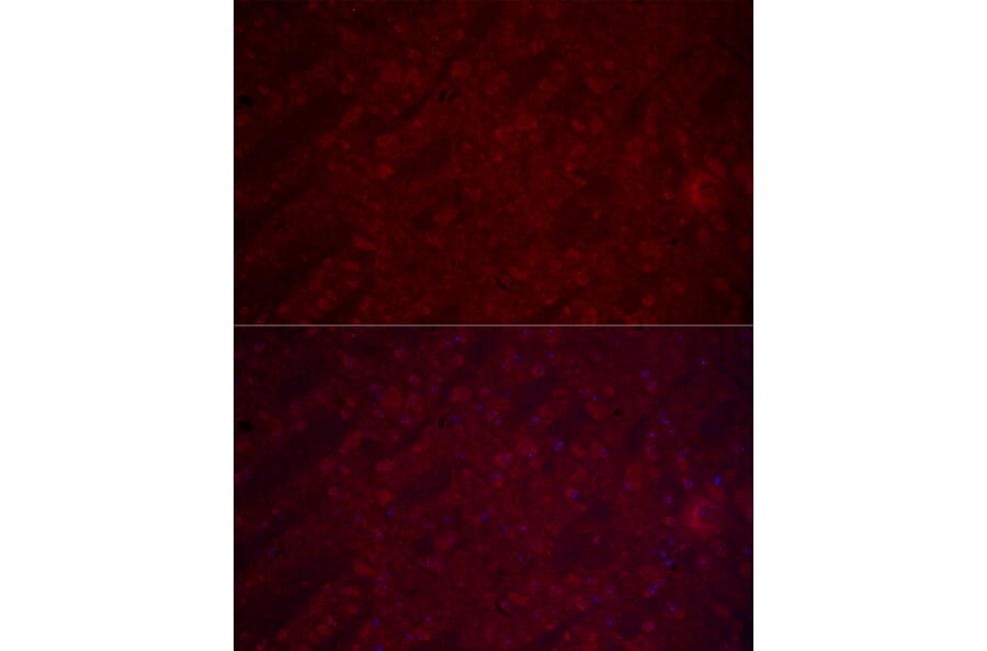 Immunofluorescence - Anti-VGluT1 Antibody (A90766) - Antibodies.com