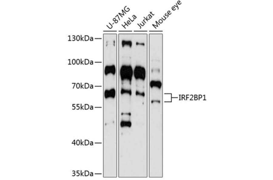 Western Blot - Anti-IRF2BP1 Antibody (A4614) - Antibodies.com