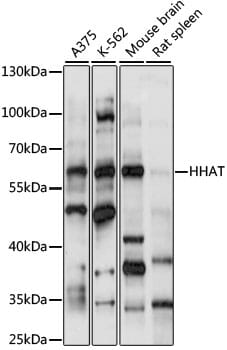 Western blot analysis of extracts of various cell lines, using Anti-HHAT Antibody (A15171) at 1:1,000 dilution.
Secondary antibody: Goat Anti-Rabbit IgG (H+L) (HRP) (AS014) at 1:10,000 dilution.
Lysates / proteins: 25µg per lane.
Blocking buffer: 3% non-fat dry milk in TBST.
Detection: ECL Basic Kit (RM00020).
Exposure time: 60s.